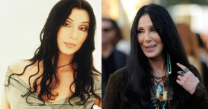 Cher - Before & After Plastic Surgery